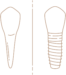 Implants Icon